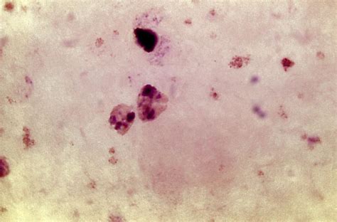 Free picture: micrograph, contains, ameboid, trophozoite, parasite, plasmodium vivax, stain
