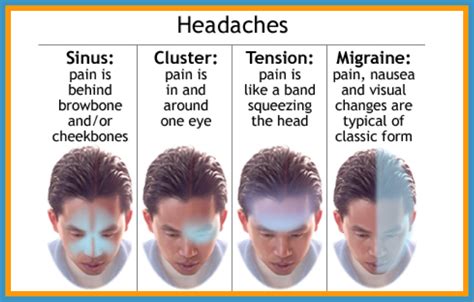Severe Migraine Headaches