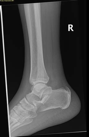 Radiology Quiz 71604 | Radiopaedia.org