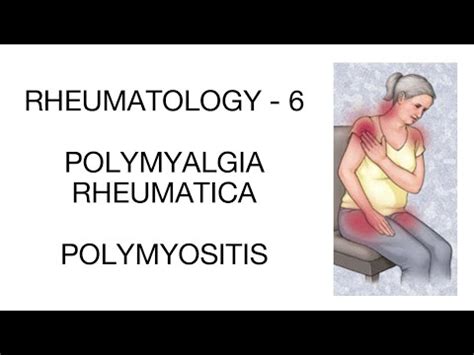 POLYMYALGIA RHEUMATICA VS POLYMYOSITIS - PLAB/USMLE/FMGE/NEETPG - RHEUMATOLOGY PART 6 - YouTube