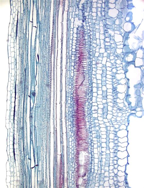 ‎Protoxylem vessel elements with annular secondary wall thickenings and ...