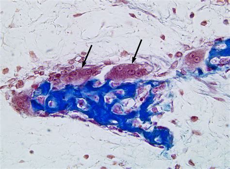 Bone and Bone Formation | histology