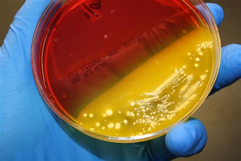 E. coli on XLD | VeeDunn | Flickr