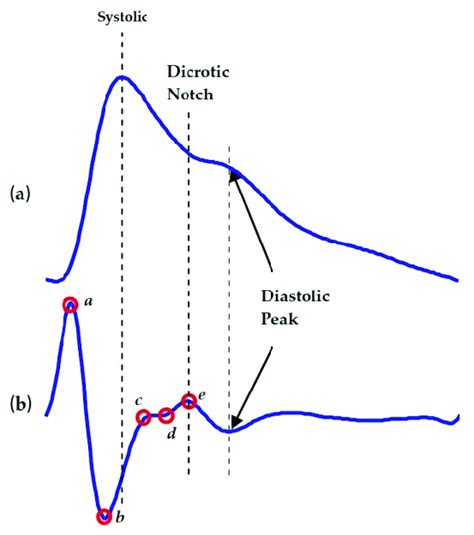 Second derivative of photoplethysmography (SDPPG) [39]. (a) Fingertip... | Download Scientific ...