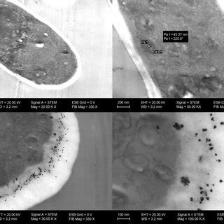 TEM images of Aspergillus brasiliensis after the growth in the ...