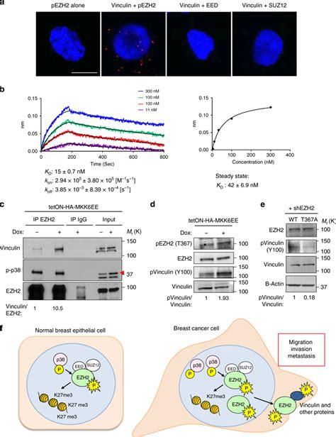 EZH2 and vinculin interact in a phosphorylation-dependent manner. a... | Download Scientific Diagram