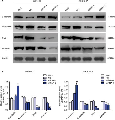 RalY knockdown caused changes in eMT marker expression levels in hCC... | Download Scientific ...