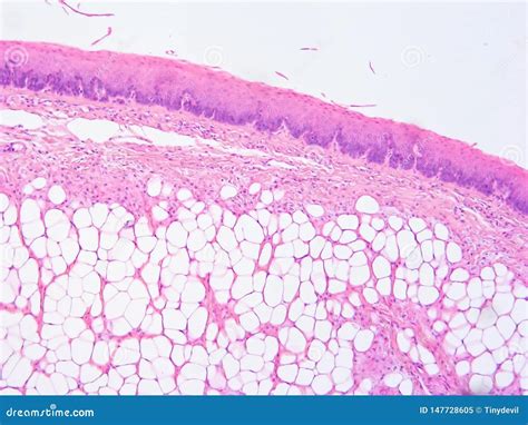 View 21 Epiglottis Histology Diagram - mediagateinterest