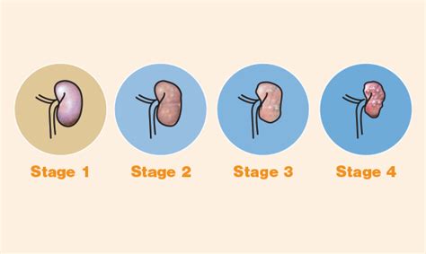 The International Renal Interest Society adds the IDEXX SDMA Test to ...