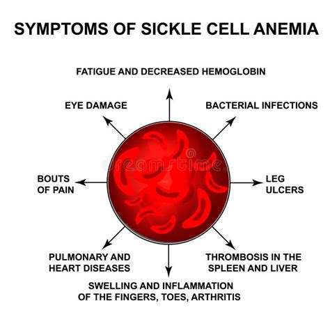 Symptoms of Sickle Cell Anemia. World Sickle Cell Anemia Day 19 June. Red Blood Cells ...