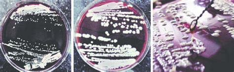 (A) Changes in Staphylococcus aureus colony morphology, (B) and Colony... | Download Scientific ...