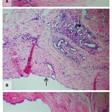 Bile duct histology. This figure demonstrates H&Estained sections of... | Download Scientific ...