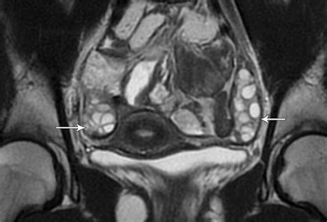 Sumergido Doctrina Alcalde mri female pelvis anatomy Frente Casco Madurar