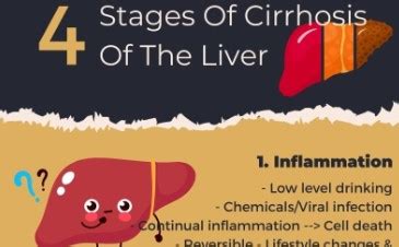 What Are The Four Stages Of Cirrhosis Of The Liver? - Abbeycare