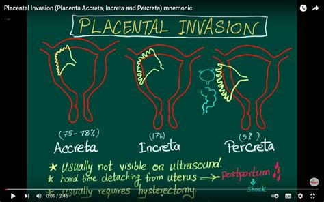 Placenta problems - placental accreta/increta and percreta - Heather Bruce