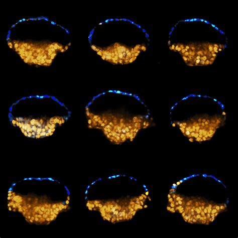 Controlled modelling of human epiblast and amnion development using stem cells | Research ...