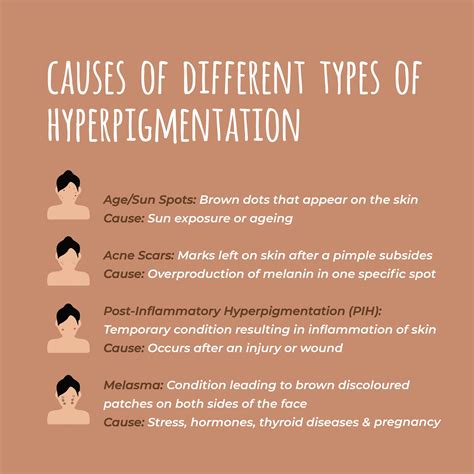 Hyperpigmentation: Symptoms, Causes Treatment