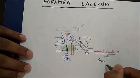 Skull Foramen- 3, Foramen Lacerum and Carotid Canal Content | TCML and ...