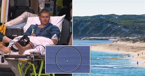 Australia surfer mauled by shark breaks free and swims to safety in WA | World News | Metro News