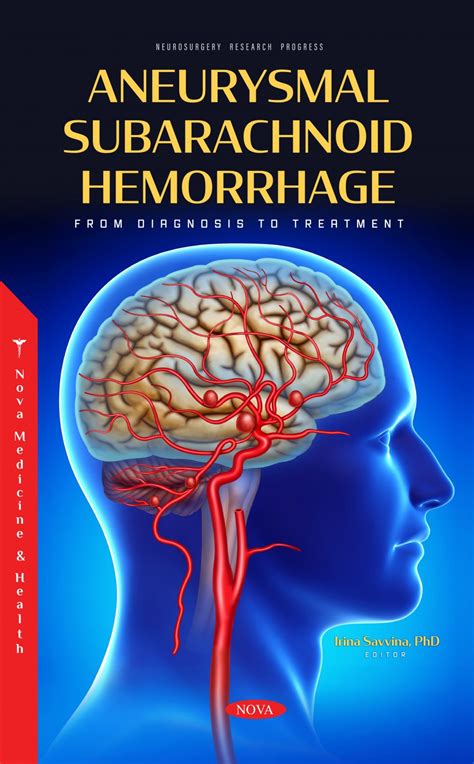 Subarachnoid Hemorrhage Symptoms Treatment Stroke Ane - vrogue.co