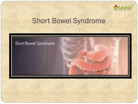 PPT - Short Bowel Syndrome: Causes, Symptoms, Daignosis, Prevention and ...