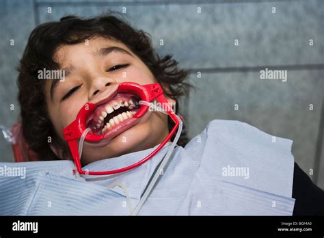 Boy with mouth opener during orthodontic work Stock Photo: 27377560 - Alamy