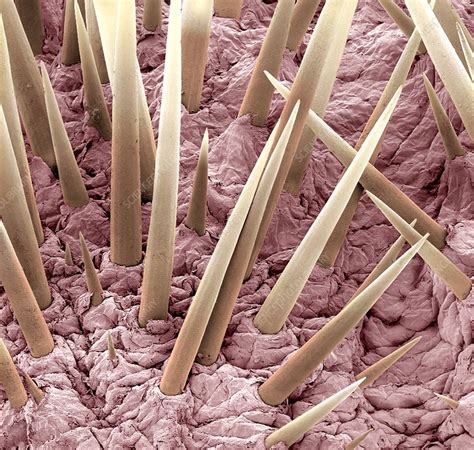 Hedgehog spines, SEM - Stock Image - C007/1267 - Science Photo Library