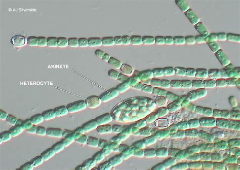 Anabaena ~ Everything You Need to Know with Photos | Videos