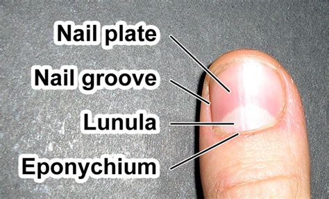 Nail (anatomy) - wikidoc