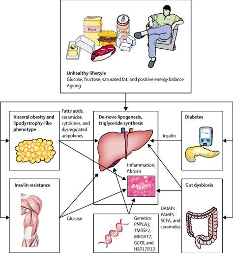 Non-alcoholic fatty liver disease: causes, diagnosis, cardiometabolic ...