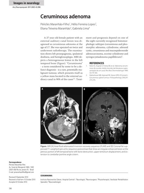 (PDF) Ceruminous adenoma.