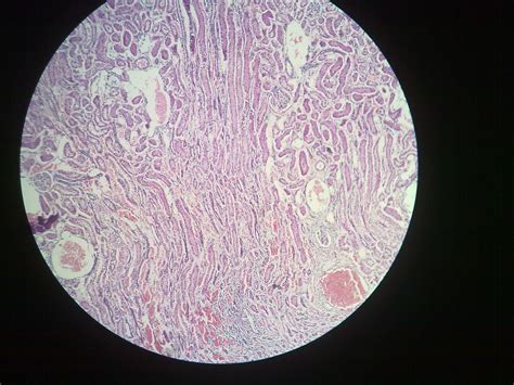 Kidney Histology – howMed