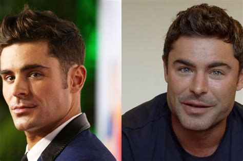 ‘Jaw gate’– Zac Efron denies he’s done plastic surgery | Graaff-Reinet ...