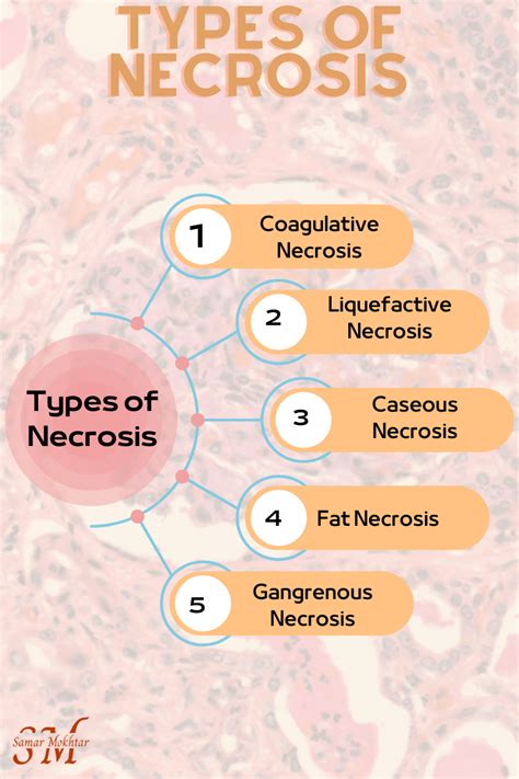 What are the signs for each type of necrosis? - Jalees