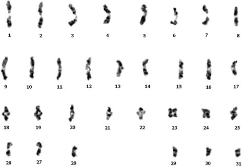 What is Karyotype And idiogram?