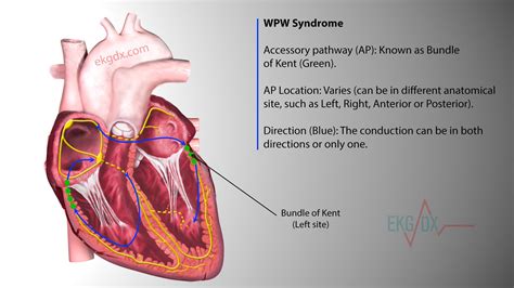 Bundle Of Kent Anatomy