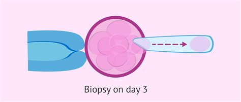 What is embryo biopsy?