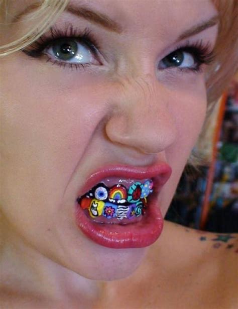 Get Best Colors On Braces Pictures