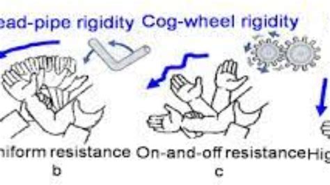 Cogwheel Rigidity