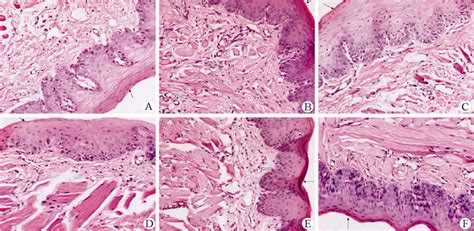 Histological images of the buccal mucosa of the left side and the... | Download Scientific Diagram