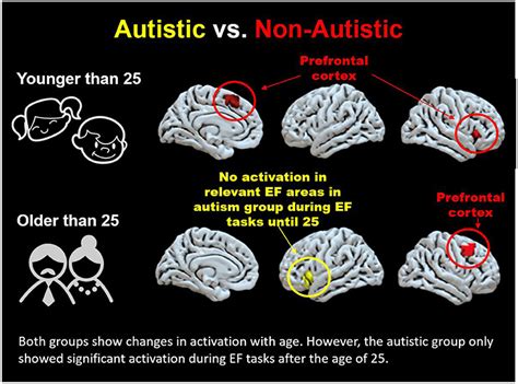 Integrating Brain Imaging Results to Better Understand Autism ...