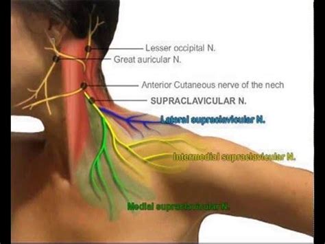 ULTRASOUND GUIDED SELECTIVE SUPRACLAVICULAR NERVE BLOCK - YouTube