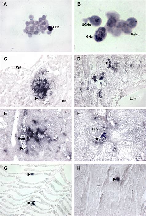 In situ hybridization. In situ hybridization was used to assess the... | Download Scientific Diagram