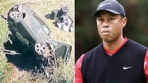 Tiger Woods: Golf legend hospitalised after car crash