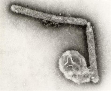 Image of the Week: What H5N1 looks like - Scope