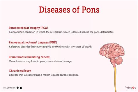 Pons (Human Anatomy): Image, Functions, Diseases and Treatments