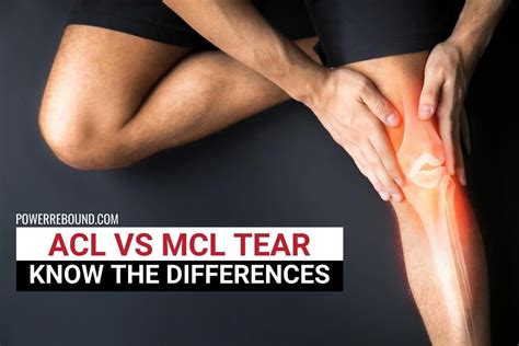 ACL vs MCL Tear: Know the Differences | Mcl injury, Acl, Knee ligament injury