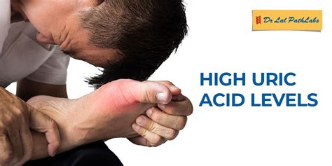 High Uric Acid Levels: Causes, Diagnosis, and Prevention - Dr Lal PathLabs Blog