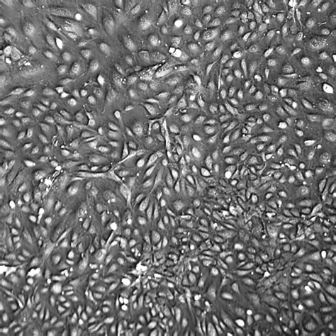 HUVEC 10-Donor Human Umbilical Vein Endothelial Cells