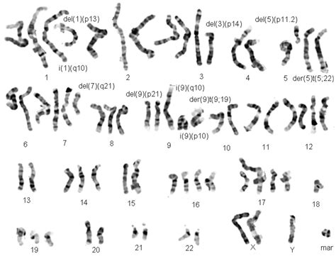 IJMS | Free Full-Text | Cytogenetics and Cytogenomics Evaluation in Cancer